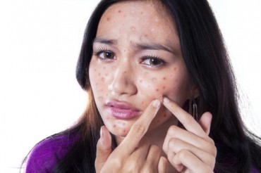 Skin Care Mistakes