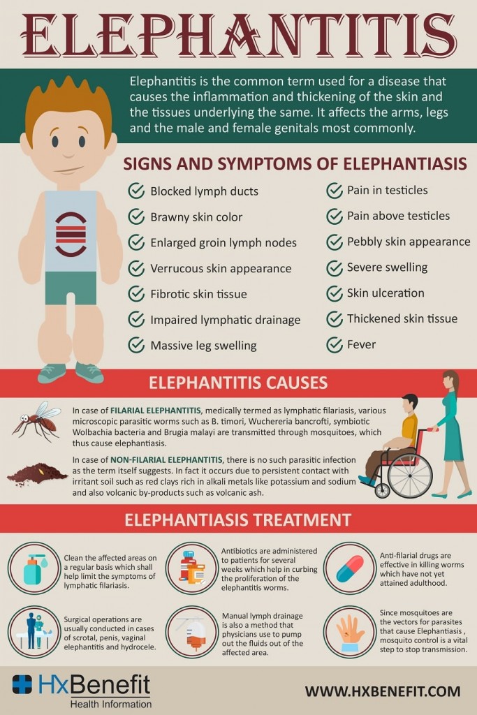 Elephantitis
