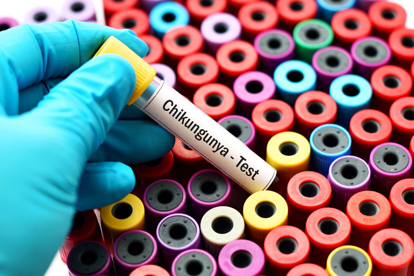 Chikungunya Test