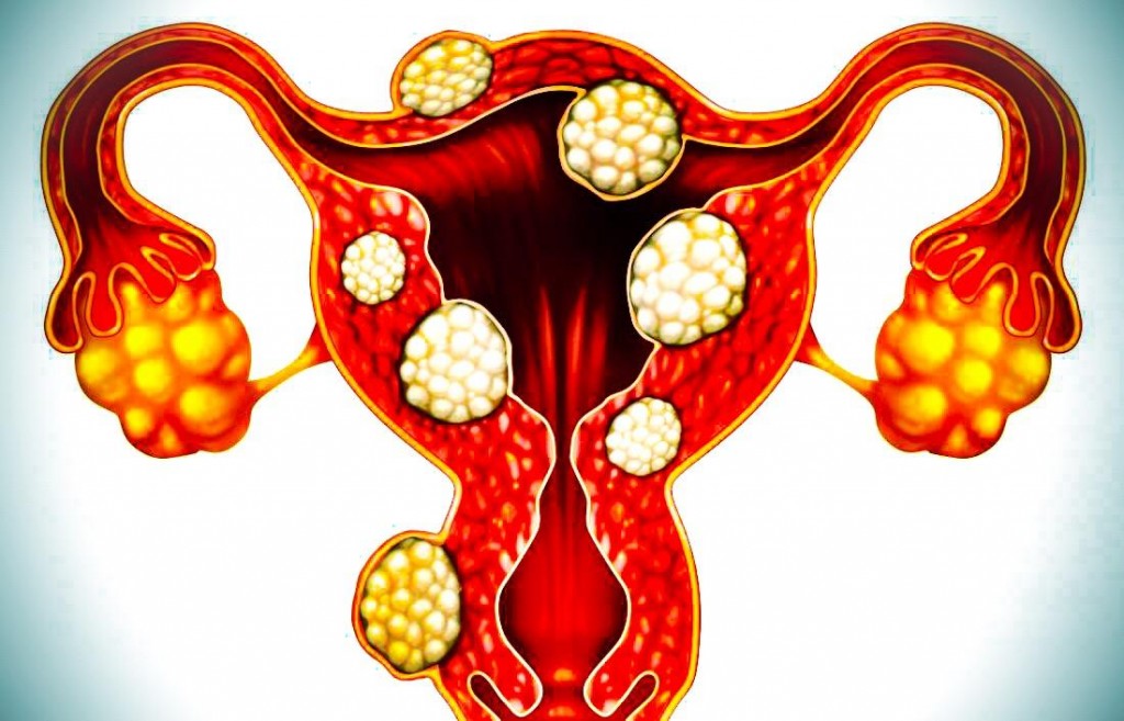 spiritual-root-of-uterine-fibroids